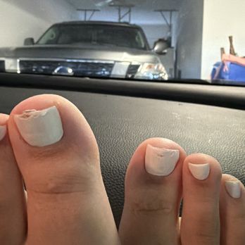 Venetian Nail Lounge - Messed up pedicure - Nail Salons Near Me - Surprise, Arizona
