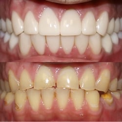 Hillcrest Family Dental