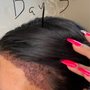 Photo of Biltmore Surgical Hair Restoration