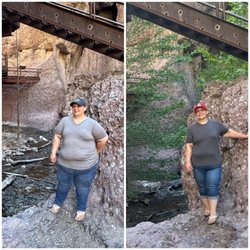 Renew Bariatrics - Catwalk, NM