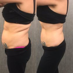 Davianne - Bodicurrent Treatment