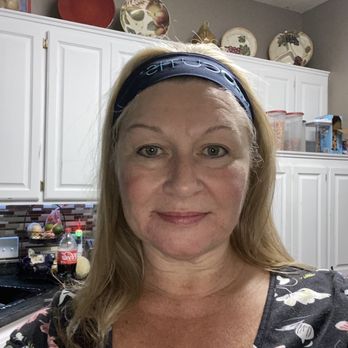 Radiance Medspa - 1 hour post procedure. - Medical Spas Near Me - Woodbury, Minnesota Radiance Medspa - 1 hour post procedure. - Medical Spas Near Me - Woodbury, Minnesota
