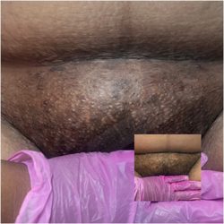 Waxing with Davonda  - Before and after Brazilian