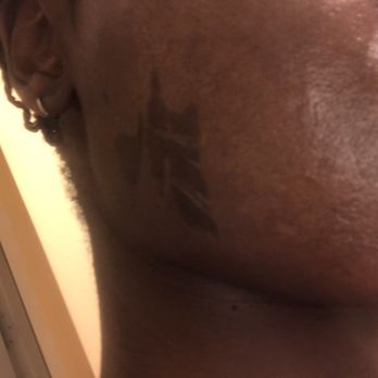 Ulta Beauty - Right cheek burned from the wax! - Cosmetics & Beauty Supply Near Me - Waldorf, Maryland Ulta Beauty - Right cheek burned from the wax! - Cosmetics & Beauty Supply Near Me - Waldorf, Maryland