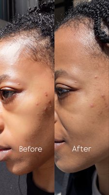 Heyday Skincare Beverly by null