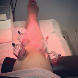 Meditree Acupuncture Clinic - 1st time trying this