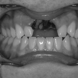 Paso Robles Endodontics