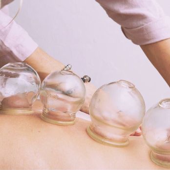Wren Acupuncture - Cupping therapy. - Acupuncture Near Me - Los Angeles, California Wren Acupuncture - Cupping therapy. - Acupuncture Near Me - Los Angeles, California