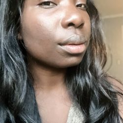 Skin Forensics - Where my skin is today. My texture and hyperpigmentation have improved so much.