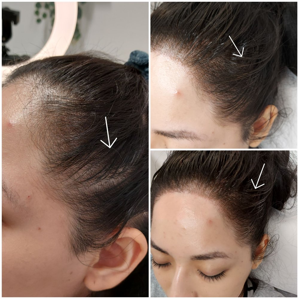 Crystal Pure Skin Care Logo