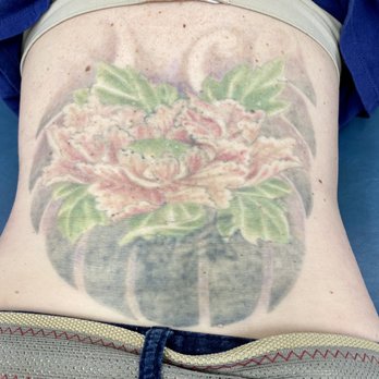 Removery Tattoo Removal & Fading - After red's healing from 4 weeks ago. Having black and green worked on today.  2/6/21 - Tattoo Removal Near Me - Round Rock, Texas