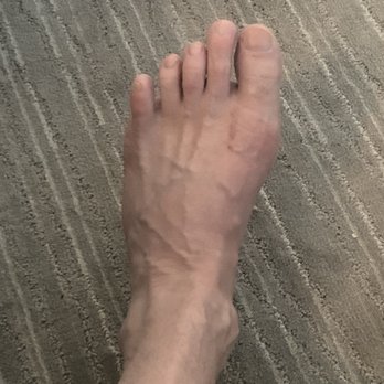 Benjamin E. Stein, MD - All better ...beautiful I must say and works perfect! - Orthopedists Near Me - Washington, DC, District of Columbia