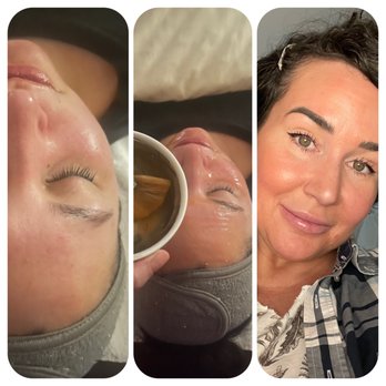 Tonya's Ageless Skin Spa - Jelly mask. Before, during and that after glow - Skin Care Near Me - Houston, Texas Tonya's Ageless Skin Spa - Jelly mask. Before, during and that after glow - Skin Care Near Me - Houston, Texas