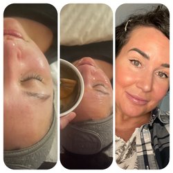 Tonya's Ageless Skin Spa - Jelly mask. Before, during and that after glow
