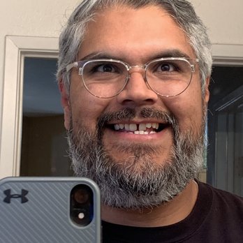 Del Sol Dental - This was my smile before the treatment... - General Dentistry Near Me - Ontario, California