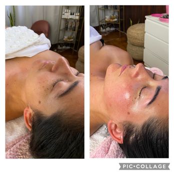 SD Skin Aesthetics - Massage Near Me - La Mesa, California SD Skin Aesthetics - Massage Near Me - La Mesa, California