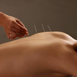 Blue Lotus Acupuncture - Untitled