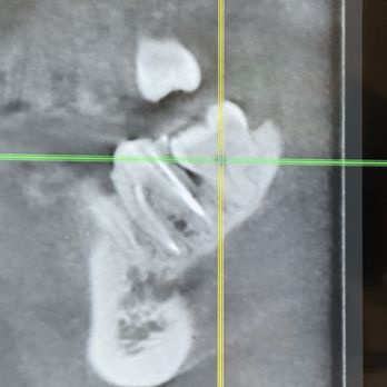Orange Oral Surgery - Oral Surgeons Near Me - Orange, California