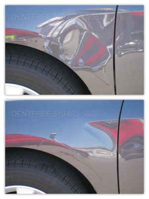 Photo of DentFree - San Leandro, CA, US.