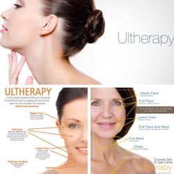 Beyond Beauty Aesthetics - Ask about Ulthera