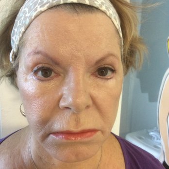 R5 Skinworks - After Purifying Facial - Skin Care Near Me - Clearwater, Florida R5 Skinworks - After Purifying Facial - Skin Care Near Me - Clearwater, Florida