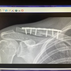The injury...