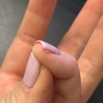 Fantasy Nail Salon - It looks small but anyone who went through this knows how bothersome and hurting this can be lol - Nail Salons Near Me - Ontario, California