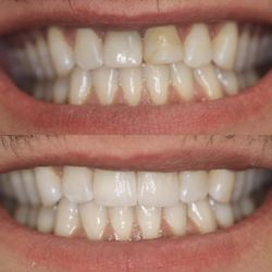 SoCal Dental Care
