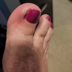 Euphoria Nail Spa - redness and swelling, feverish
