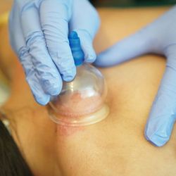 Solution Heal - Cup slides on body to draw toxin buildup and muscle tension out from deeper layers in our body and stimulate fresh oxygenated circulation.