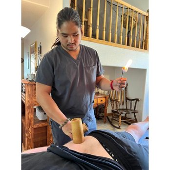 S&Y Mobile Acupuncture - Fire cupping for male with lower back pain - Acupuncture Near Me S&Y Mobile Acupuncture - Fire cupping for male with lower back pain - Acupuncture Near Me