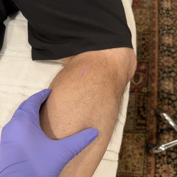 District Physical Therapy - Trigger point dry needling - Prenatal/Perinatal Care Near Me - Washington, DC, District of Columbia District Physical Therapy - Trigger point dry needling - Prenatal/Perinatal Care Near Me - Washington, DC, District of Columbia