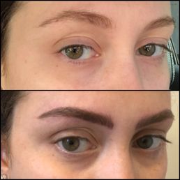 Before + After Before + After