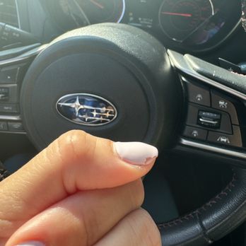 Paradise Nails and Spa - After 3 days - Massage Near Me - Bronx, New York Paradise Nails and Spa - After 3 days - Massage Near Me - Bronx, New York