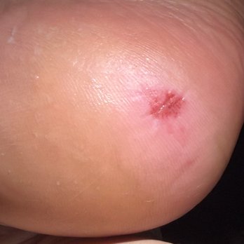 Alo Nail Bar - This is my cut that I got when they were scraping my foot - Nail Technicians Near Me - San Antonio, Texas Alo Nail Bar - This is my cut that I got when they were scraping my foot - Nail Technicians Near Me - San Antonio, Texas