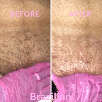Skin.d By Lin - Brazilian Wax - Waxing Near Me Skin.d By Lin - Brazilian Wax - Waxing Near Me