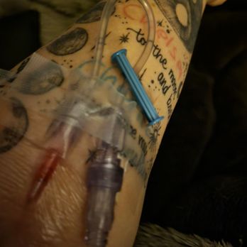 Baylor Scott & White Emergency Hospital - Murphy - This is my arm at home with the IV still in it. - Emergency Rooms Near Me - Murphy, Texas Baylor Scott & White Emergency Hospital - Murphy - This is my arm at home with the IV still in it. - Emergency Rooms Near Me - Murphy, Texas