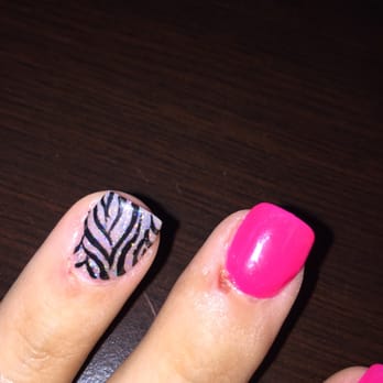 LA Nails - The sores on my cuticles from filing them down too far. - Nail Salons Near Me - Roseville, Minnesota