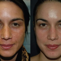 Skin For All People