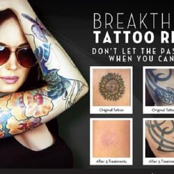 EvolvMD MedSpa & Body Contouring - Remove your tattoo in half the time of traditional lasers. We can treat the widest range of ink colors, even tattoos that wer...