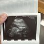 Photo of Prenatal Ultrasound of Glendale