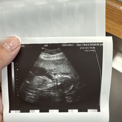Prenatal Ultrasound of Glendale - Baby girl laying down