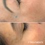 Photo of Viva Vanish Skin Solutions