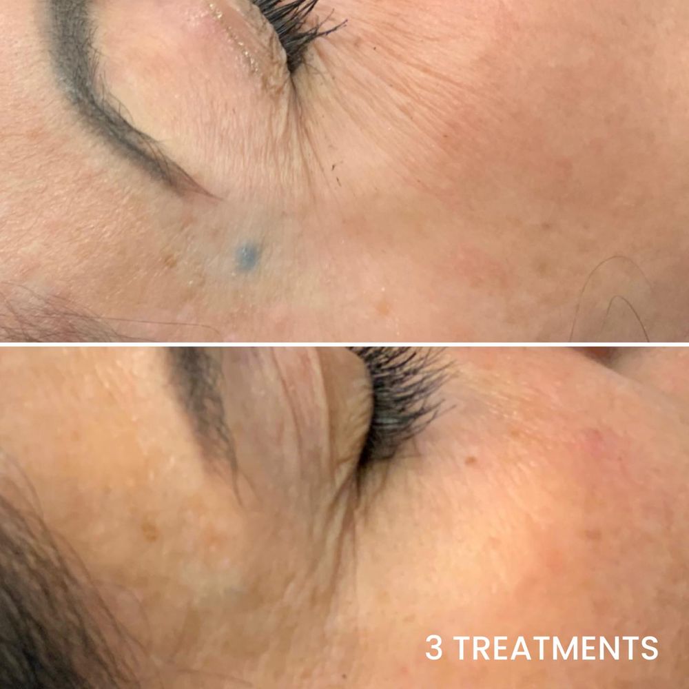 Viva Vanish Skin Solutions