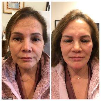 Deborah Marciano  DO - Attiva Skin tightening - Pediatricians Near Me - Great Neck, New York