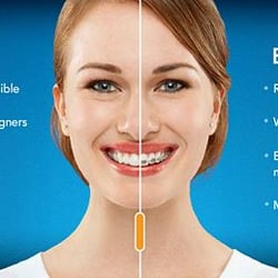 Club Center Dental & Orthodontics - Invisalign Sacramento, CA