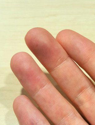 Associated Neurologists of Southern Connecticut