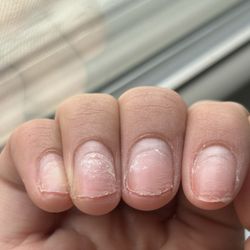 West Plaza Nails, Salon & Spa - I sent them these pictures and they told me it was my fault.. These rings are deep into my nail bed. I  wanted a refund which they declined.