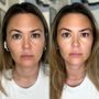 Photo of TAKAGI BROWS