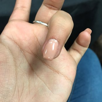 Queen Nails - Scabs on just one of the 4-5 fingers my cuticles were shaved through (this was over a week ago, so they're already mostly healed up) - Nail Salons Near Me - Anaheim, California Queen Nails - Scabs on just one of the 4-5 fingers my cuticles were shaved through (this was over a week ago, so they're already mostly healed up) - Nail Salons Near Me - Anaheim, California